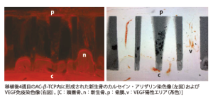 移植後4週目のAC-β-TCP内に形成された新生骨のカルセイン・アリザリン染色像（左図）およびVEGF免疫染色像（右図）。[C：頭蓋骨、n：新生骨、p：骨膜、v：VEGF陽性エリア（茶色）]