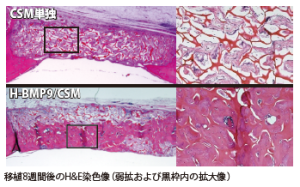 移植8週間後のH&E染色像（弱拡および黒枠内の拡大像）